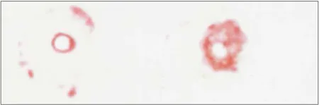 Fig. 2 Scanned image of Pressurex film after compression. fig 2