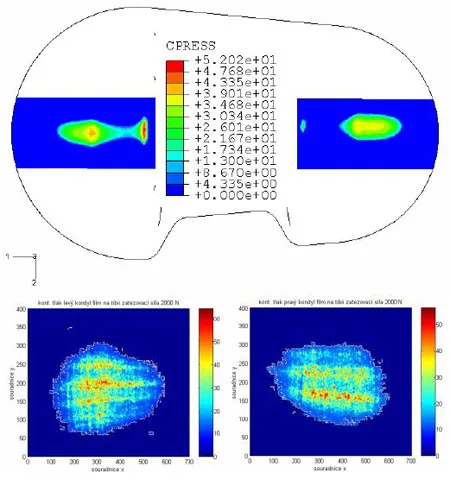 Fig. 7 – Comparison of contact pressure results: F=2000 N fig 7