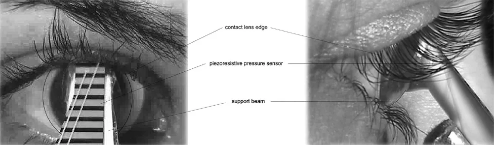 FIGURE 1. Front view <i>(top left)</i> and side view (<i>top right)</i> of an eyelid pressure measurement using a pressure sensor mounted on a specially designed rigid contact lens with plastic support beam. Schematic of sensor-contact lens combination <i>(lower)</i> with R (back surface radius of curvature) and D (diameter). All<br />
curves are spherical with an asphericity of 0 unless otherwise stated. front and side view of eyelid presure