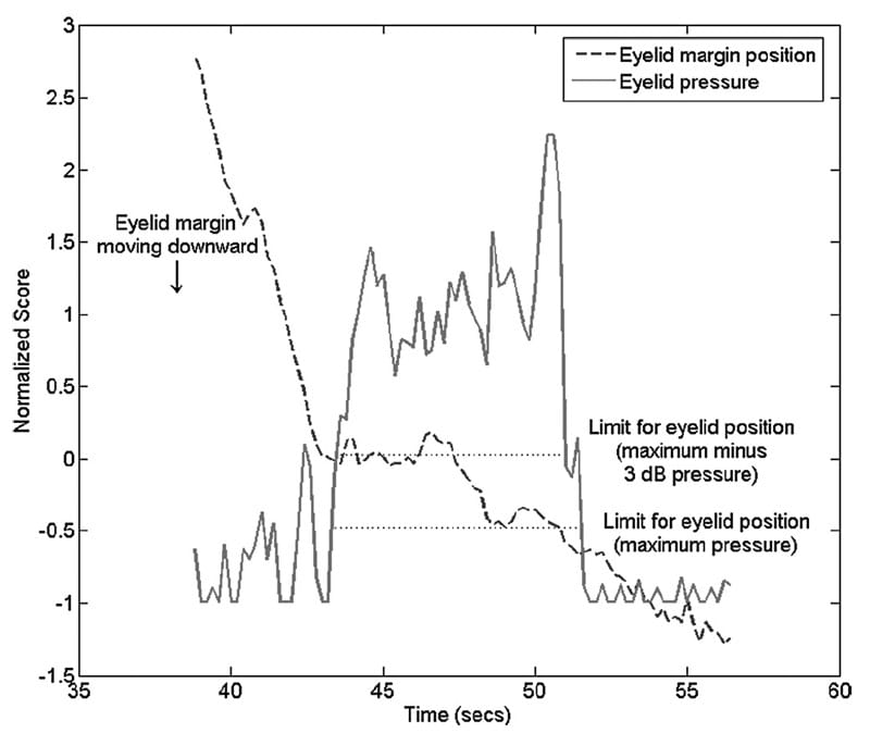 normalized values