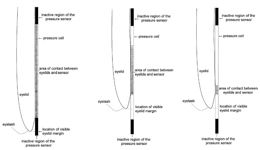 Possible models of eyelid contact