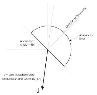 Figure 1. Joint reaction force diagram. Figure 1. Joint reaction force diagram.
