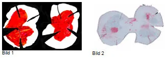 Biomechanics Abb. 27: Vergleich der Kontaktflächen in der Belastungsstufe 100%, 314N (W2-26, rechte Tibia) Bild 1: Silikonabdruck Bild 2: Druckfilm (Fuji SLow)