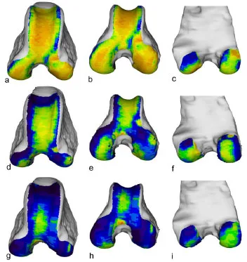 Biomechanics Abb. 33: Vergleichende Darstellung der individuellen Knochendichteverteilung der Facies articularis femoris von drei verschiedenen Hunden. a - c: linker Femur eines Boxers, weiblich, 23 kg, Altersgruppe III (Hd 33) d - f: linker Femur eines DSH, männlich, 25 kg, Altersgruppe II (Hd DSH1) g - i: linker Femur eines Pudels-Mischlings, männlich, 8 kg, Altersgruppe III (Hd Pu2) Von links nach rechts: Ansicht von kranial, kraniodistal und kaudal.
