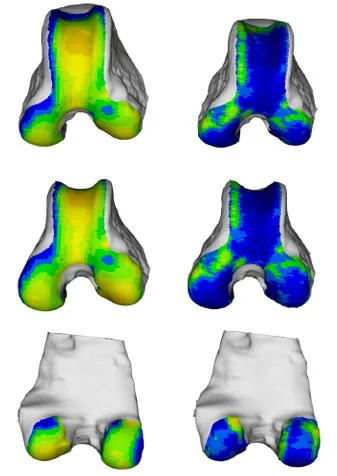 Biomechanics Abb. 39: Links, das aus den Mittelwerten 11 weiblichen Hunde rekonstruierte Objekt. Rechts, Darstellung der Standardabweichung der 11 Femora. (von oben nach unten: Ansicht von kranial, kraniodistal und kaudal)