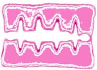 Fig 6: Fujifilm Prescale film Before Topaq Analysis