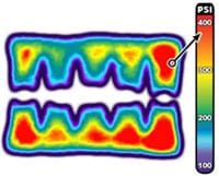 Fig 7: Fujifilm Prescale® film After Topaq® Analysis