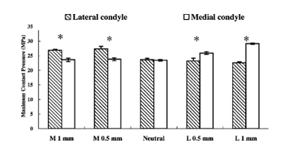MCPs in the medial (M) and lateral (L) maltranslation (mm) of femoral component relative to the normal contact alignment at 0