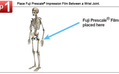 Biomechanics Analysis with Pressure Mapping Solutions