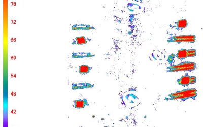 Body Mapping Techniques for Accurate Pressure Analysis
