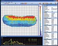 Brake Pad Pressure Distribution: Image Gallery