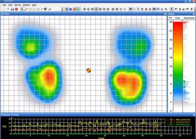 Golf Swing Sensor