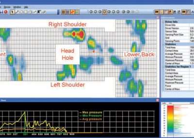 Vest Mapping
