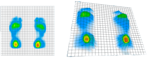 SPI is solely focused on contact surface pressure mapping solutions